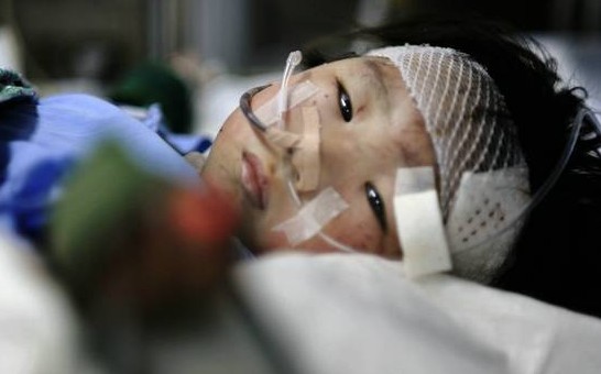 专家称伊伊心理难治疗 呼吁媒体暂缓打扰